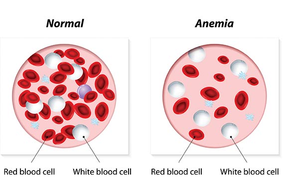 Anemia in Dogs – Causes, Symptoms, and Treatment