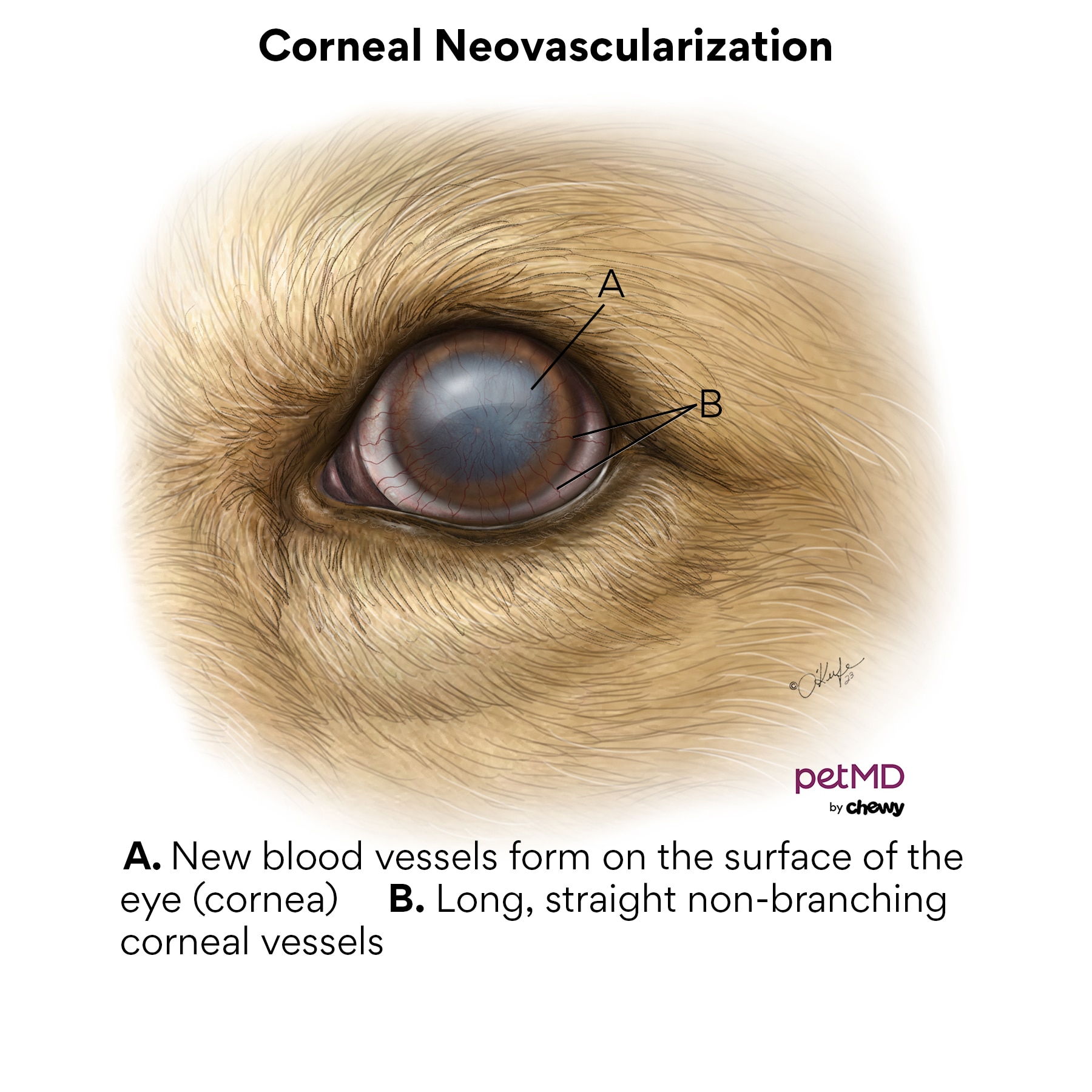 Corneal neovascularization