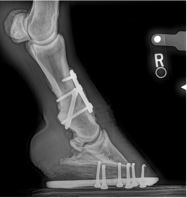 post-op arthrodesis surgery with a fused pastern joint.