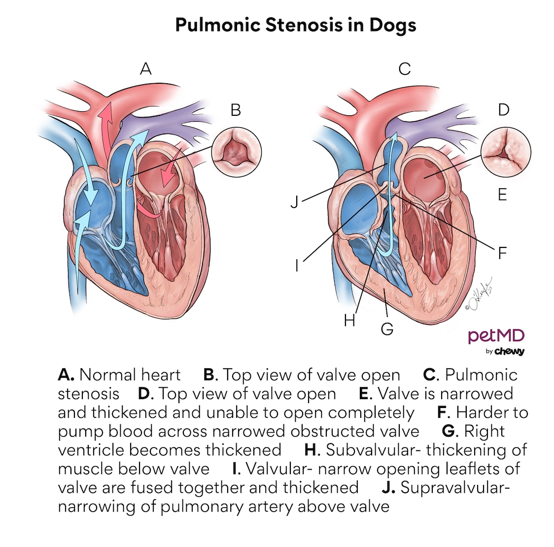 Pulmonic stenosis in dogs