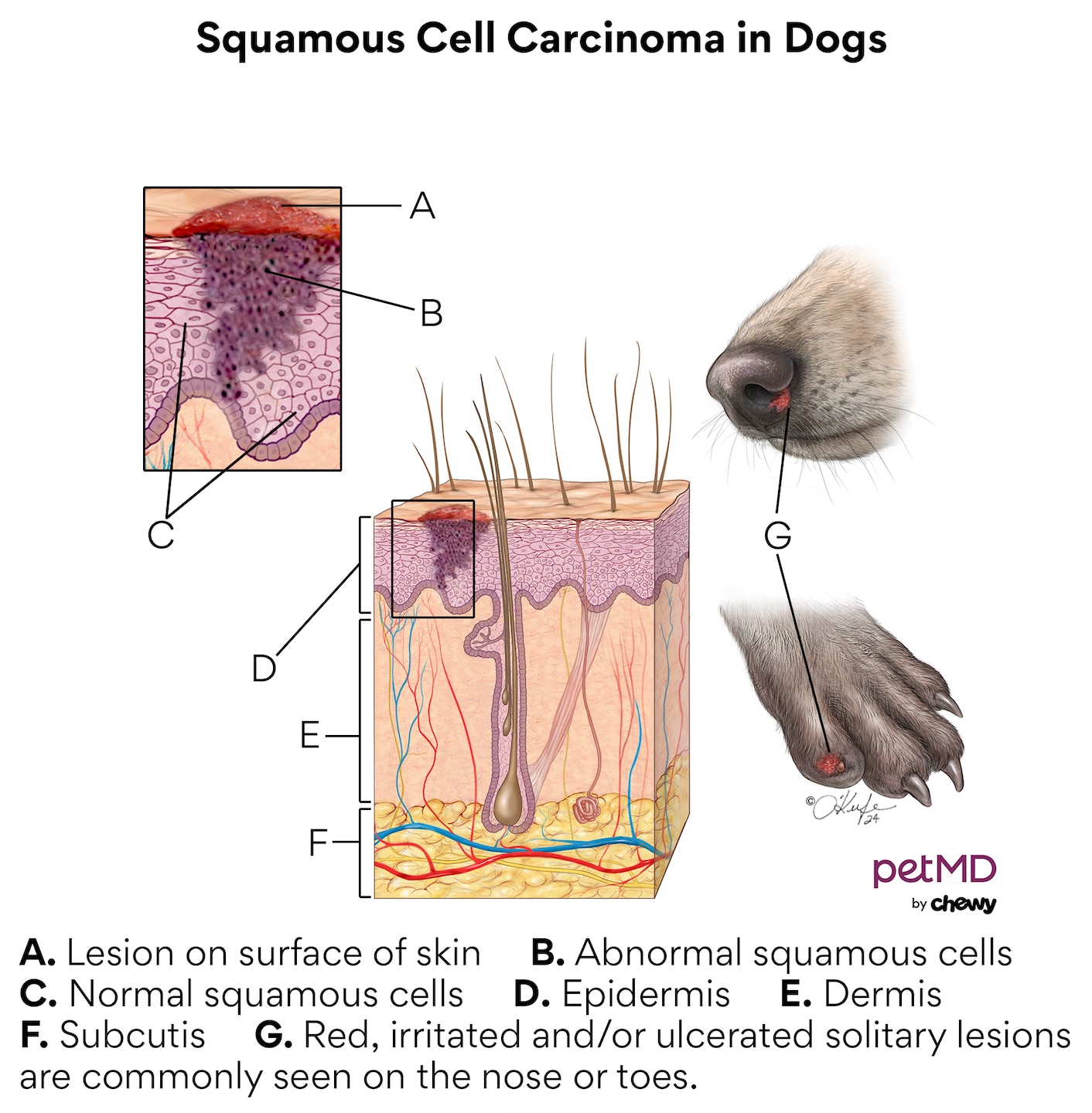 A diagram of squamous cell carcinoma in dogs.