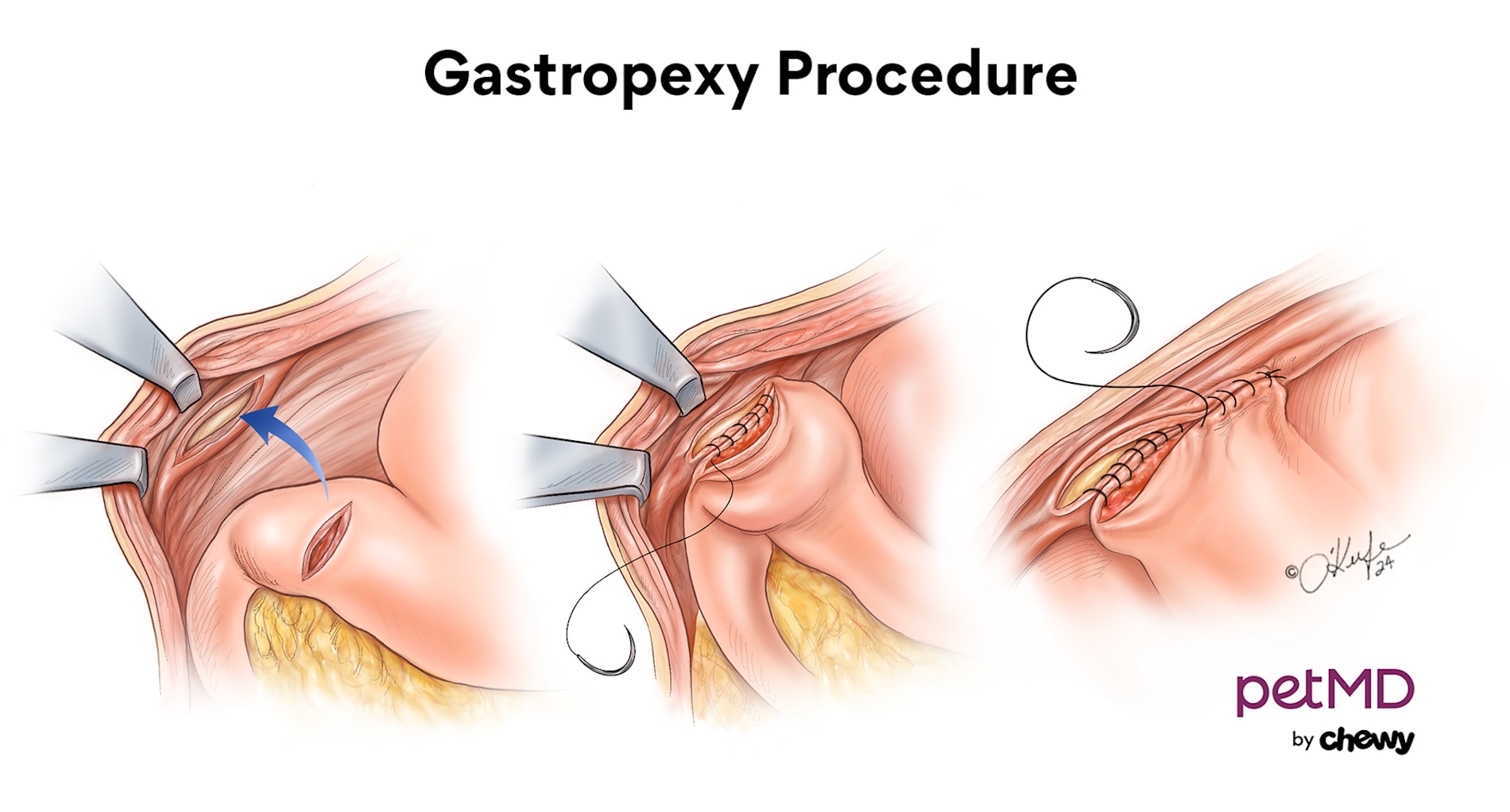 A diagram of a gastropexy procedure in dogs.