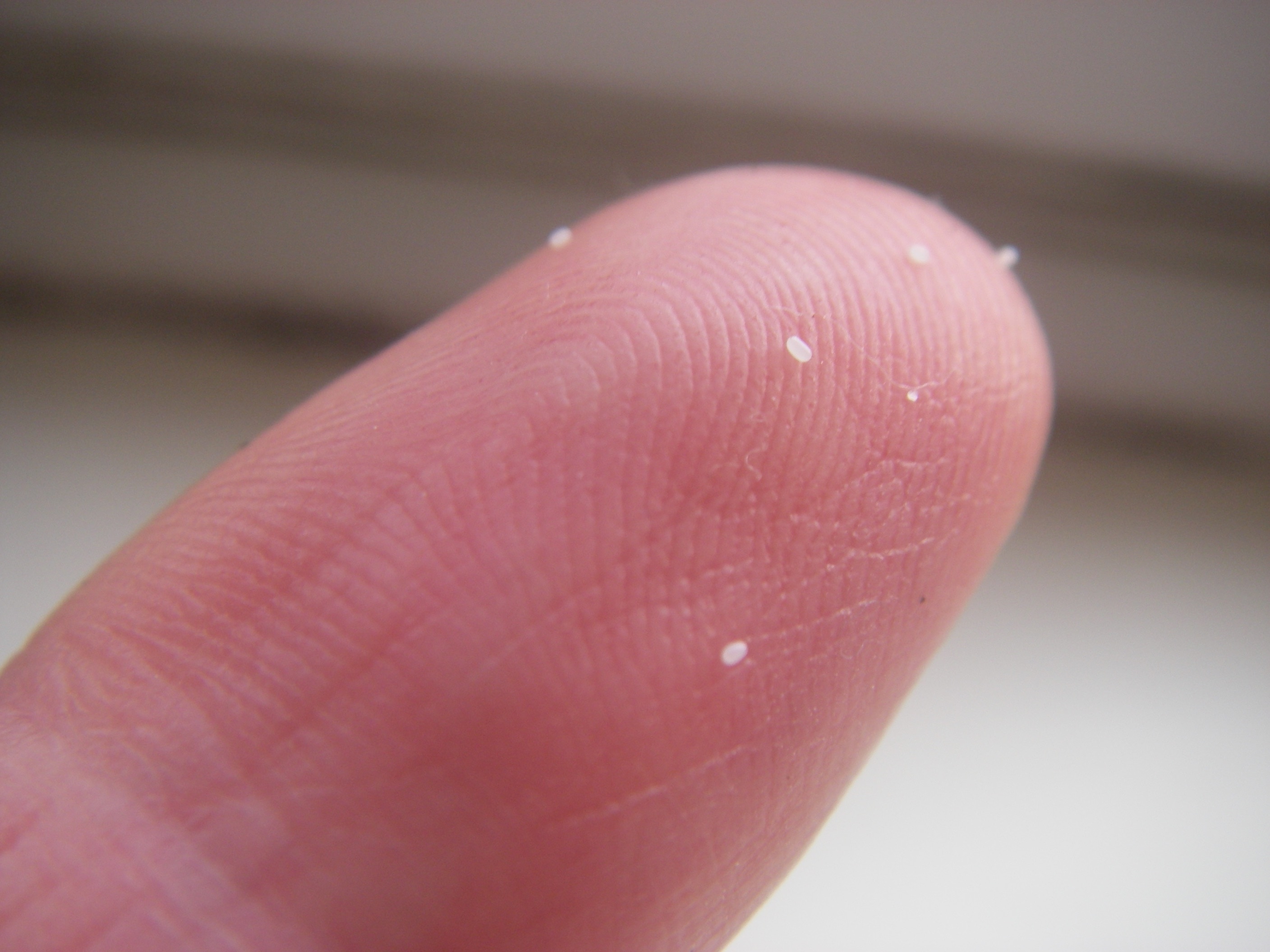 tiny white flea eggs on someone's finger