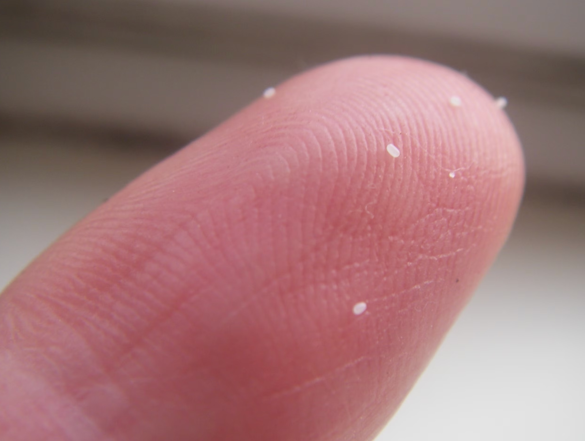 what do flea eggs look like; a finger holds up tiny white specks, which are flea eggs.