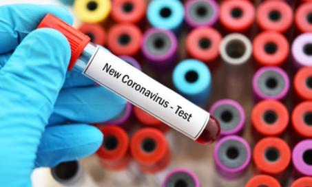 Can Pets Spread Coronavirus (COVID-19) to People?