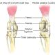 Cranial Cruciate Ligament Medical Diagram | Torn Knee Ligament in Dogs ...