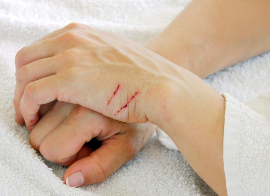 How to Treat Cat Scratches at Home | PetMD