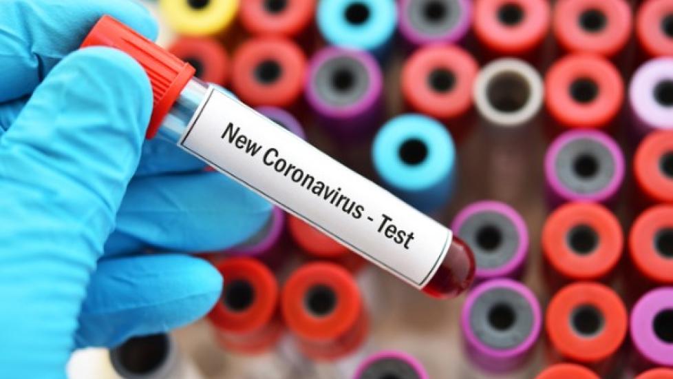 Can Pets Spread Coronavirus (COVID-19) to People?
