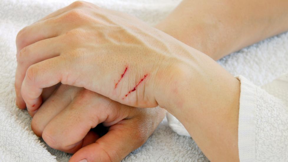 How to Treat Cat Scratches at Home